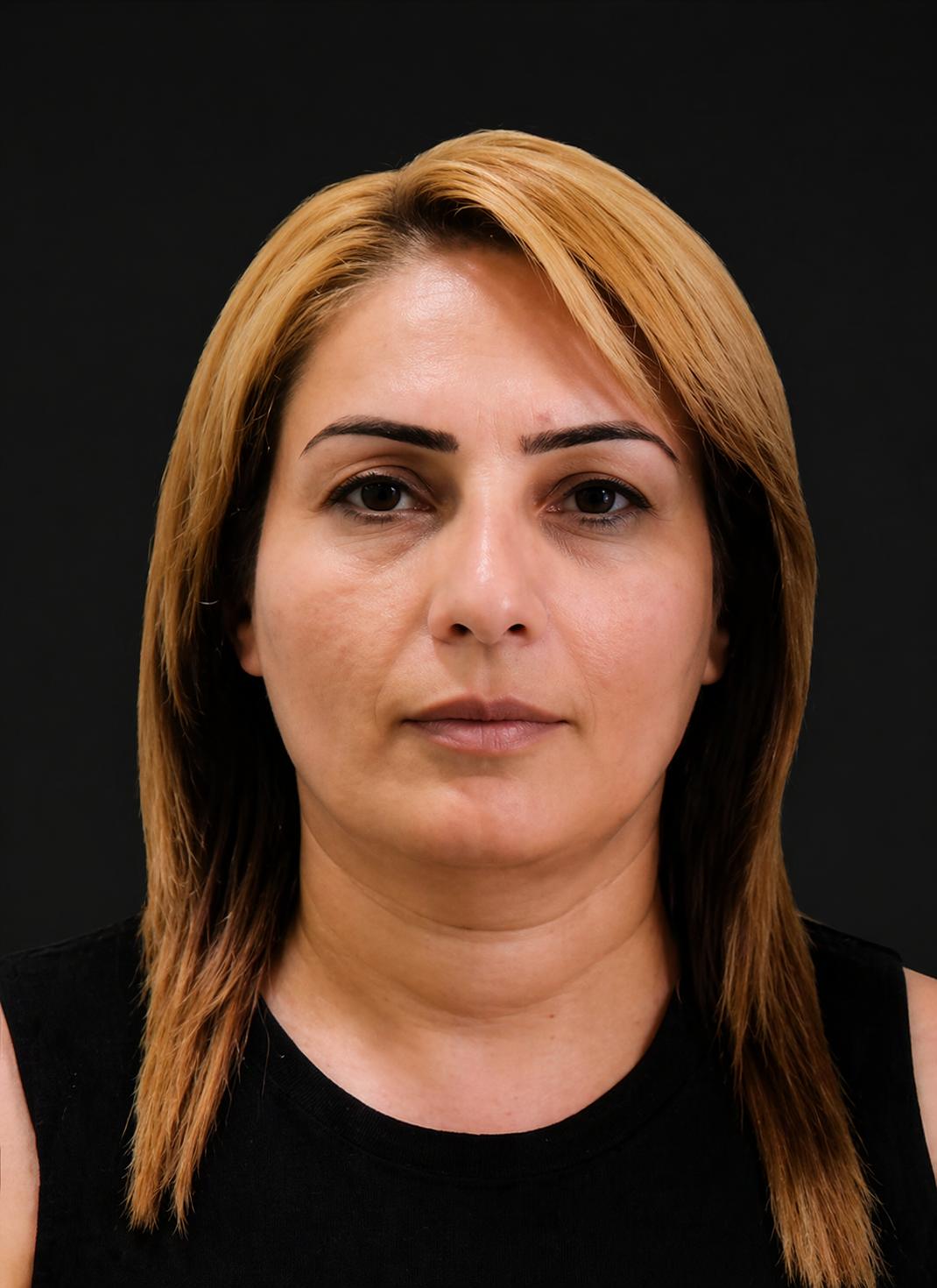 Samirə Tağıyeva